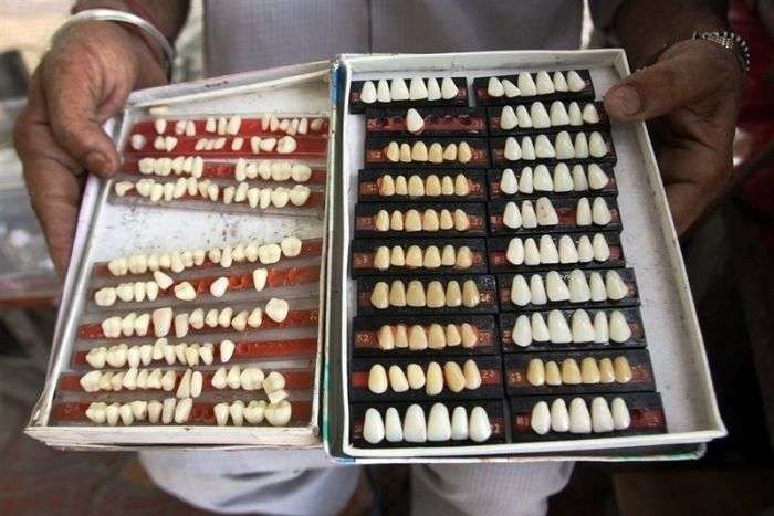Приватні стоматологи в Індії (5 фото)