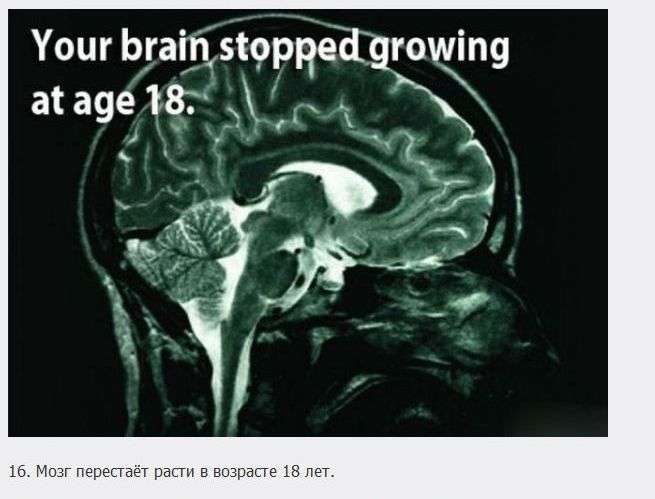 18 пізнавальних фактів про мозок (18 фото)