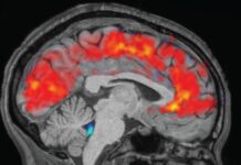 Brain ‘Zoning Out’ Explained: How Exhaustion Reshapes Neural Fluid Dynamics