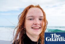 Evolutionaire winnaars: hoe natuurlijke selectie rood haar en de menselijke biologie vorm gaf